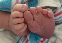 Alice - Pieds