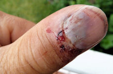 Blessure le même jour